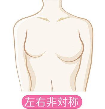 胸の形が悪いとお悩みの方必見 みんながやってる美乳にする為の4つの方法 ないぶら